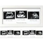 Sonogram Picture Frame - Trio Ultrasound Picture Frames  -  (Alpine White)