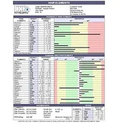 Toxic Essential Hair Elements Test
