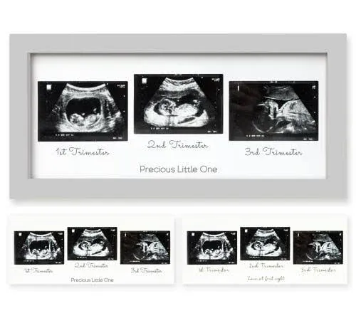 KeaBabies Trio Baby Sonogram Frame