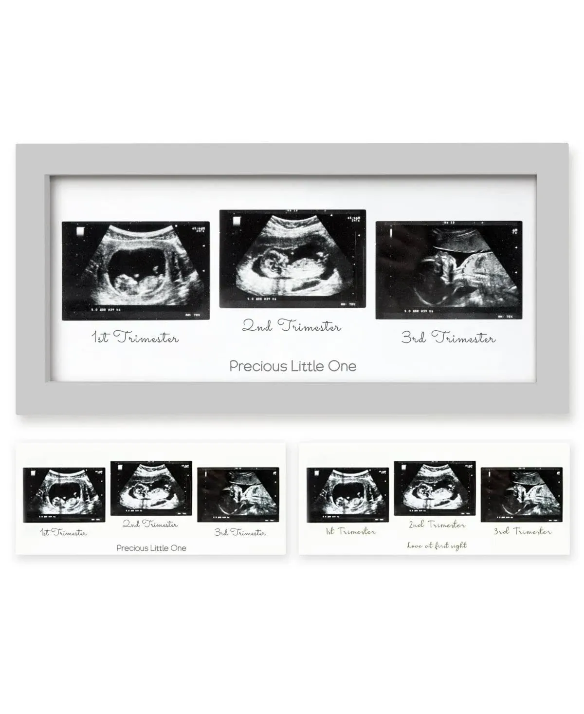 KeaBabies Trio Baby Sonogram Picture Frame, Baby Ultrasound Picture Frames for ...