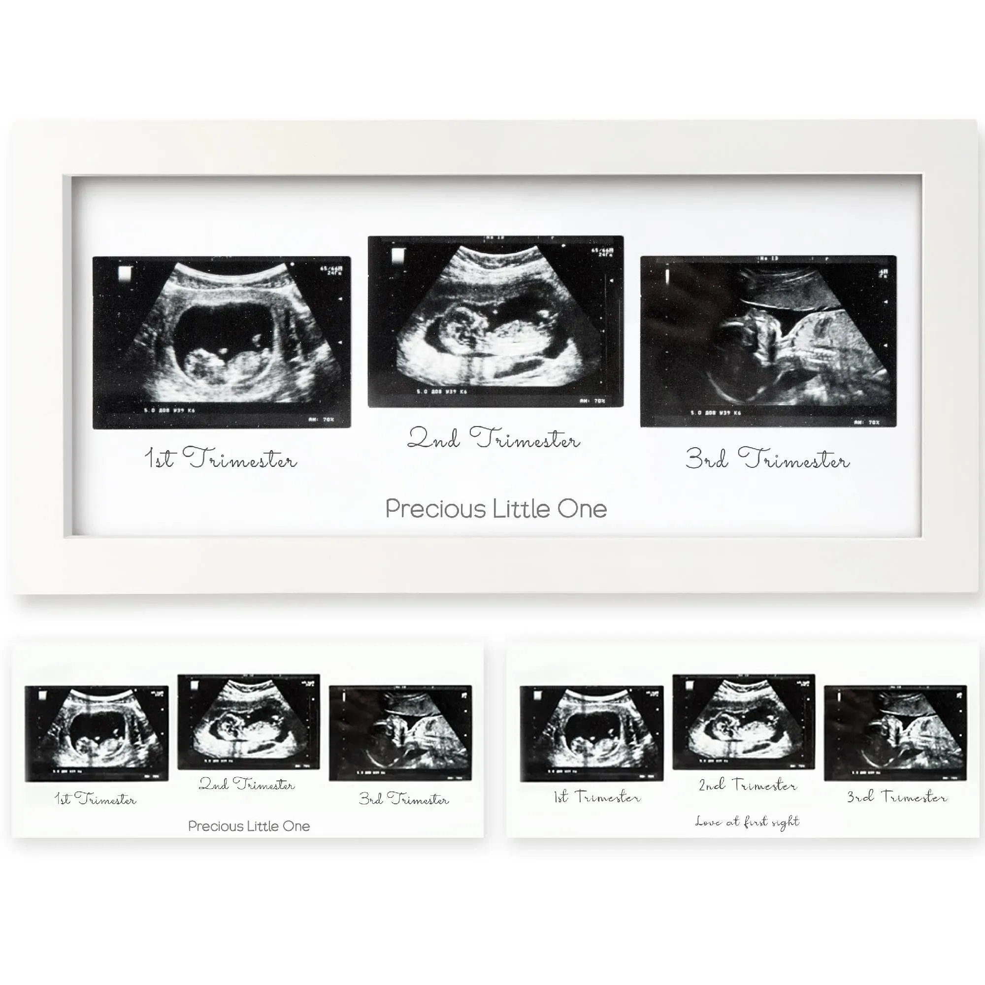 Sonogram Picture Frame - Trio Ultrasound Picture Frames For Mom To Be Gift - Baby Ultrasound frame for Pregnancy Announcements - Baby Nursery Decor, Pregnant Mom Gifts (Alpine White)