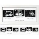 Baby Triple Sonogram Picture Frame Ultrasound Photo Frames For First Time Expect